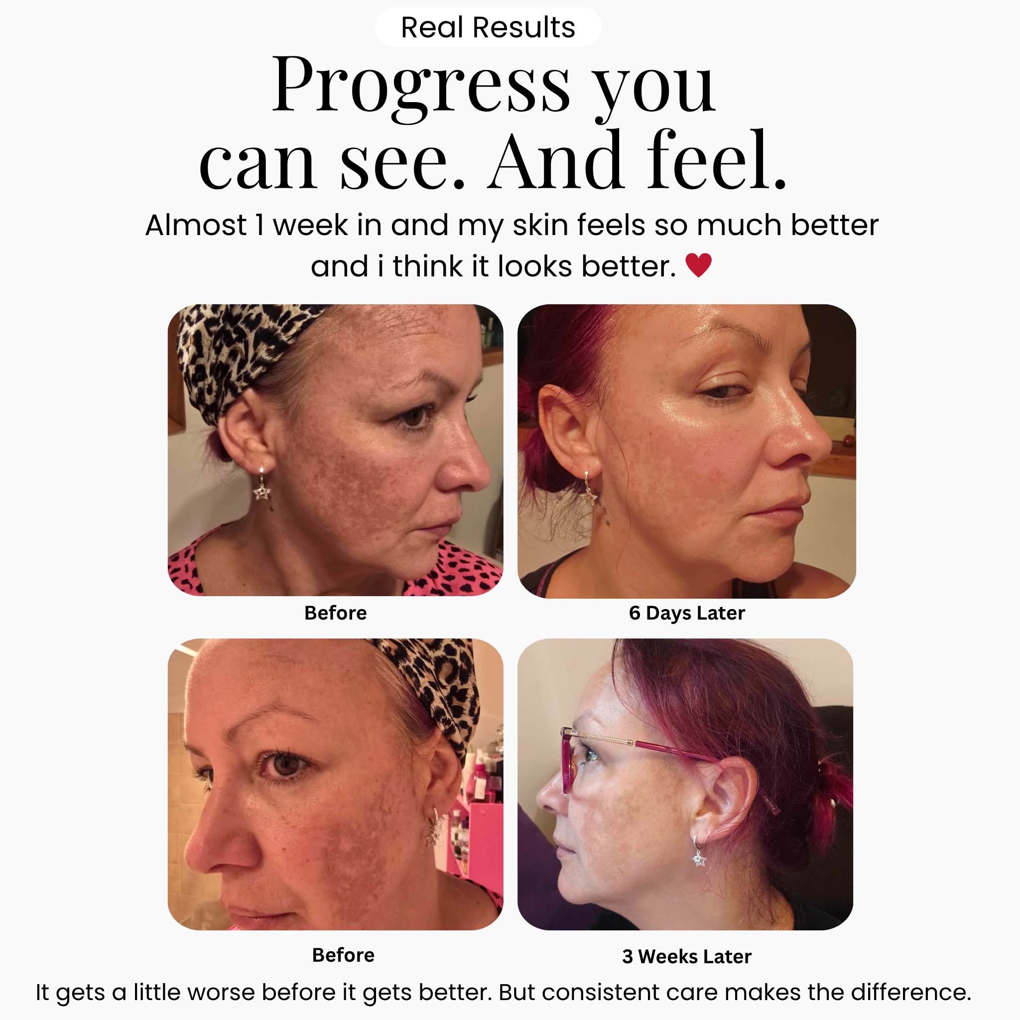 Windyigarn pigment care result example 2