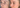 Best Melasma Treatment That Actually Works (Dermatology Ingredients Explained)