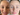 Why Aggressive Melasma Treatments Often Backfire