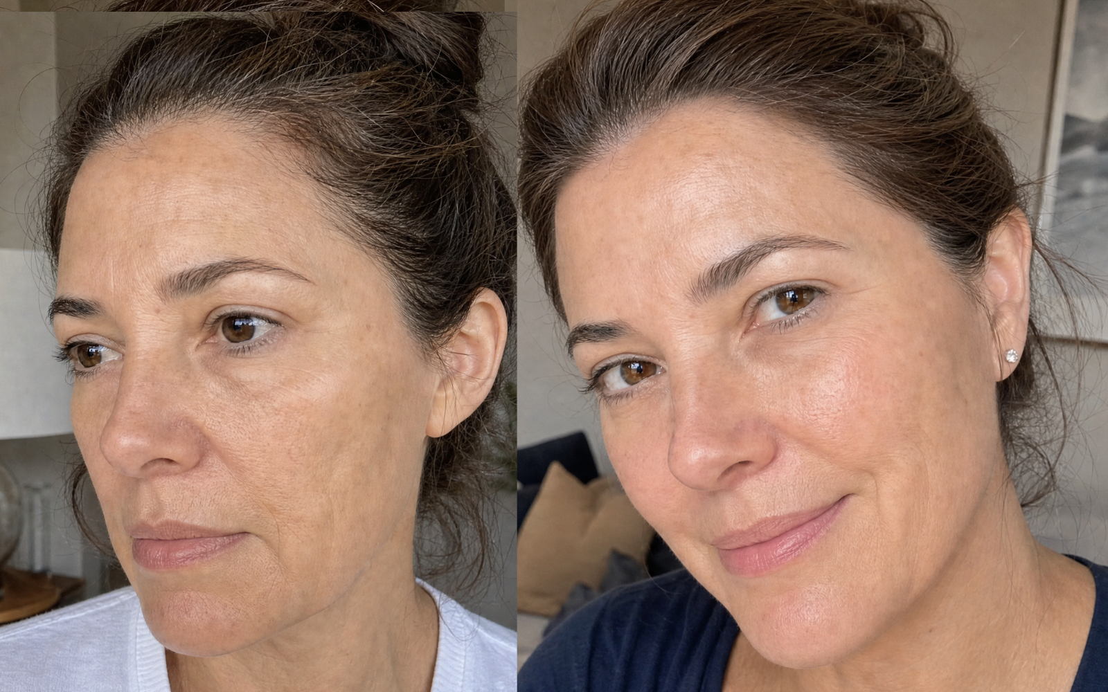 Customer before and after result showing fine lines and wrinkles