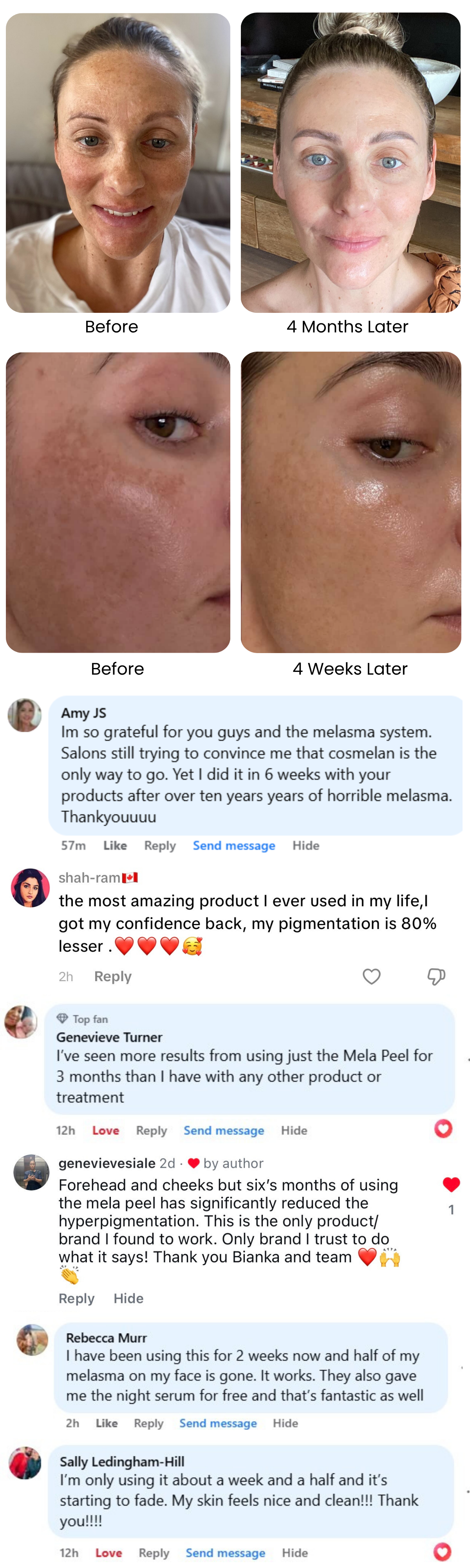 Melasma System real results and customer proof