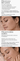 Text explaining the use of a skin treatment system for pigmentation issues with a close-up of a person's face.